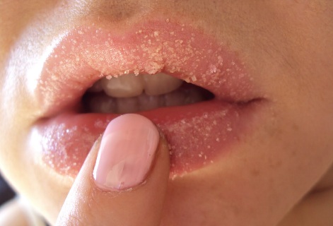 exfoliate-lips